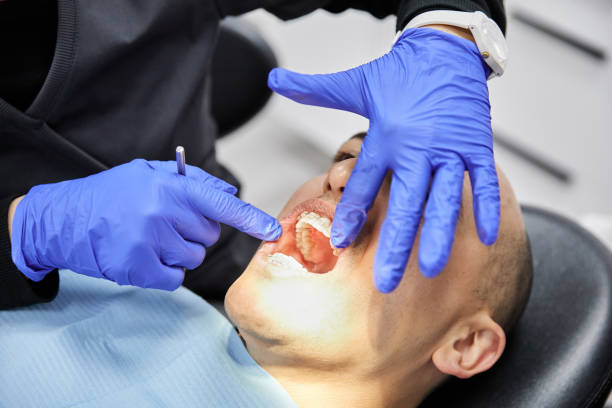 Best Urgent Care for Lost Fillings or Crowns in Franklin, NJ